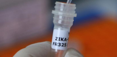 Wirus groźniejszy niż AIDS. Nadciąga światowa epidemia