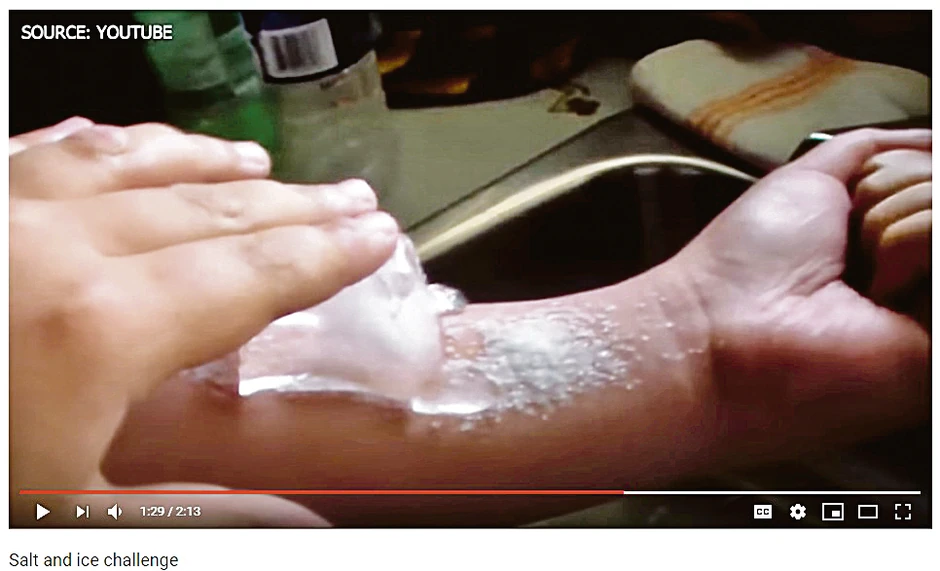 So i led izazov: zbog ovoga su mnogi imali opekotine po telu!