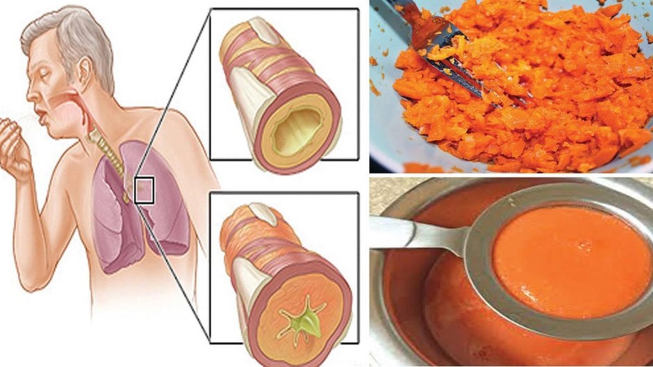 Dzięki tej substancji pozbędziecie się kaszlu i zalegającej w płucach wydzieliny