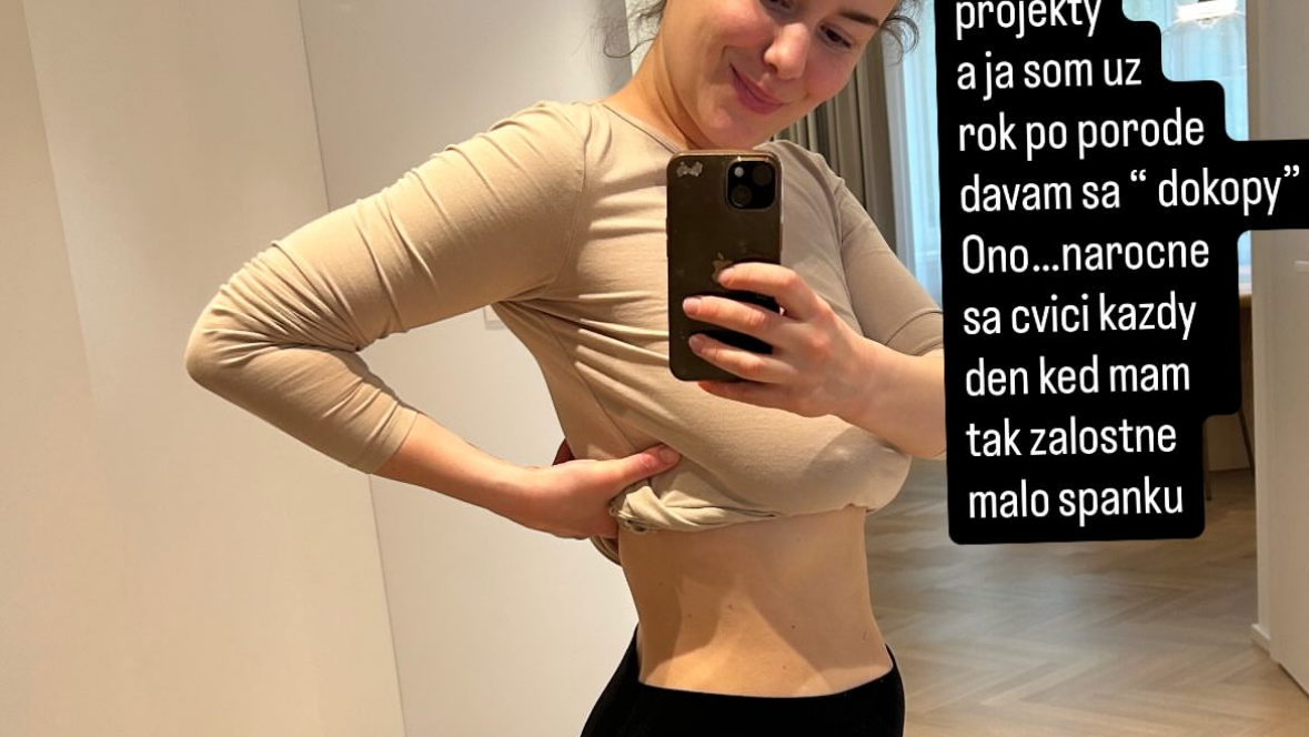 Herečka Dominika Kavaschová priznala boj s kilami / IG: @donda_kawa