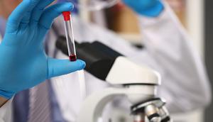 Hemgenix can be used to treat adults with hemophilia.Ivan Balvan/Getty Images