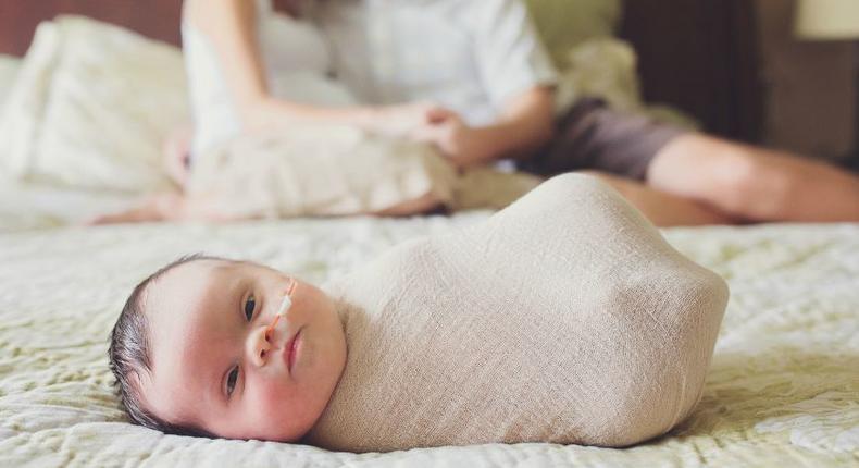 Baby Abigail born with an inoperable tumour and Down Syndrome captured by Mary Huszcza