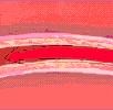 athscler0-d00000151e5591663095f