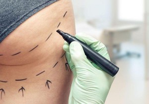 BBC | Foto: Getty Images