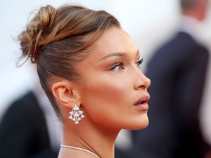 Kifejezetten undorító plasztikai műtét a sztárok hangsúlyos arccsontjának titka