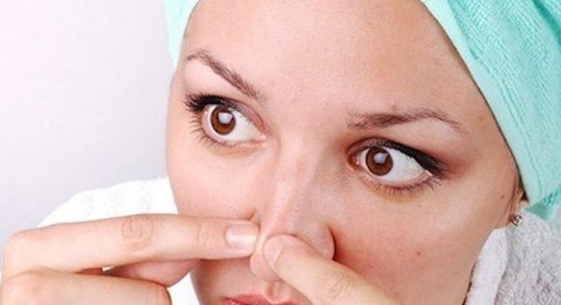 Home remedies work to remove blackheads