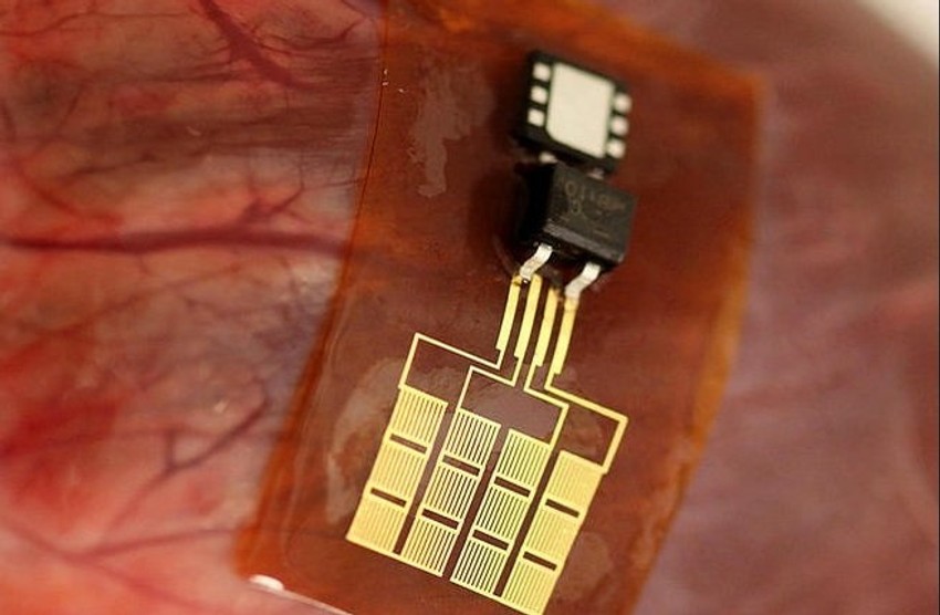 Može se nositi bilo kada i bilo gde, a naučnici već predviđaju veliki uspeh koji će ovaj izum postići, pre svega na polju medicine i prevencije određenih bolesti