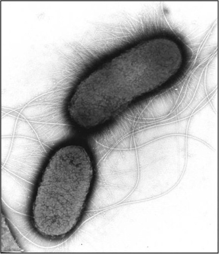 Bakteria E.coli