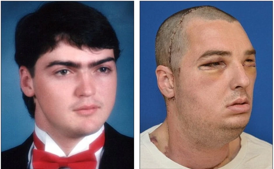 Norisu je operacija promenila život