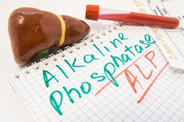 Mit jelent az ALP érték a laborleleten?