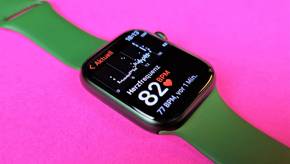 Beliebte Apple Watch Series 8 Modelle im Vergleich