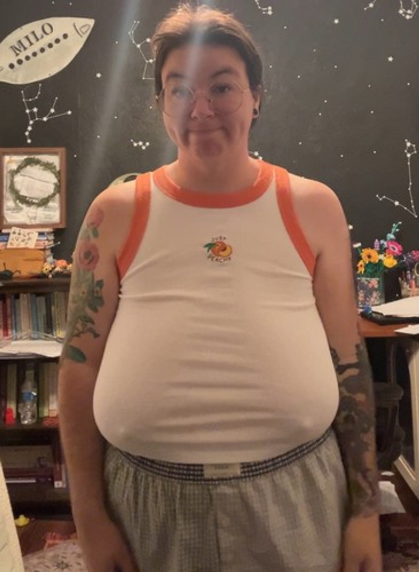 Žena morala da smanji grudi