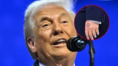 czy donald trump jest chory? nowe zdjęcia wywołały falę spekulacji o stan zdrowia