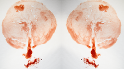 Placek o niesamowitych właściwościach. Poznaj 4 fakty o łożysku