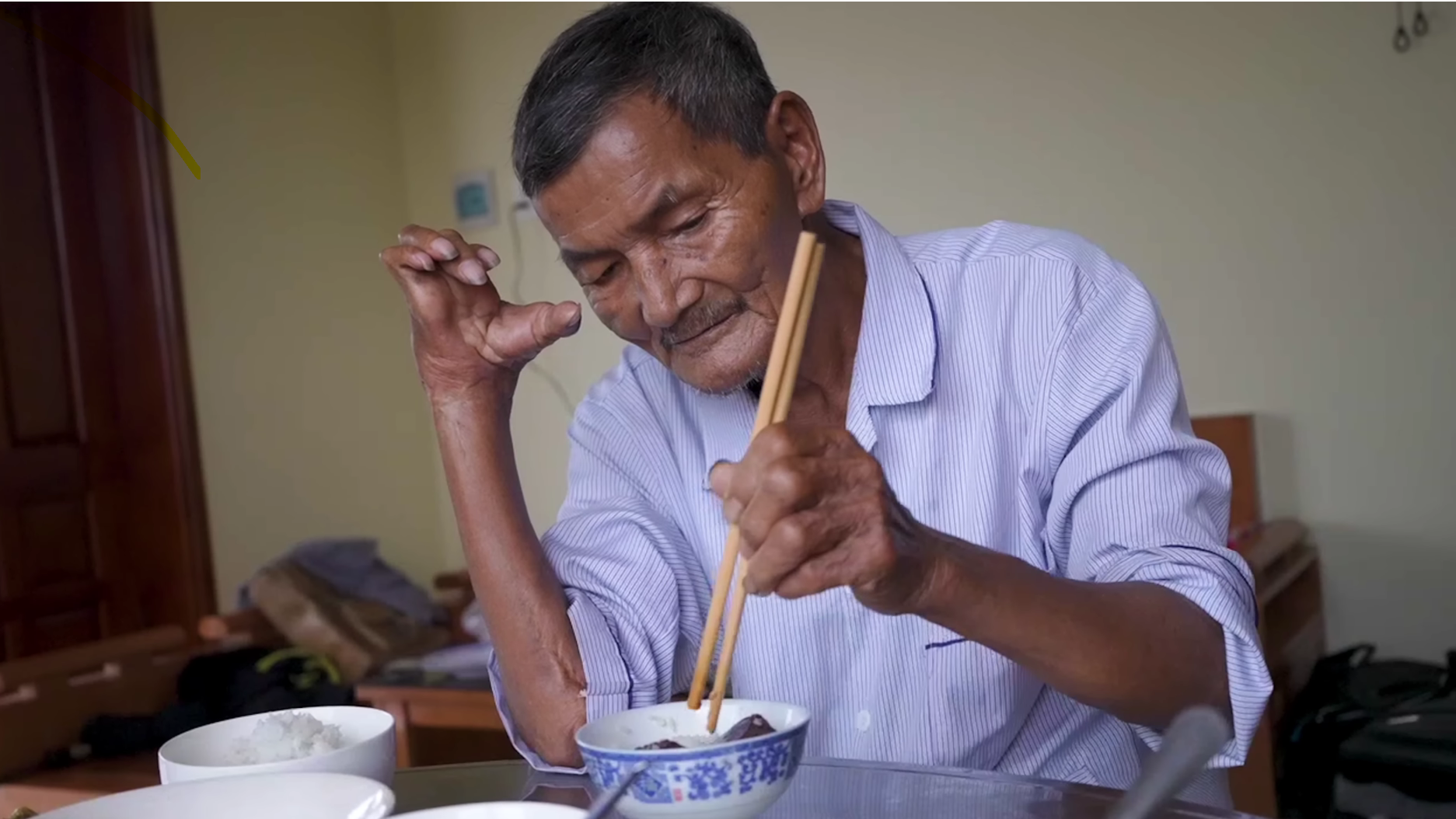 Muž z Vietnamu údajne nespal už 60 rokov.