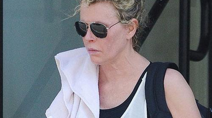 Mi történt Kim Basinger arcával?