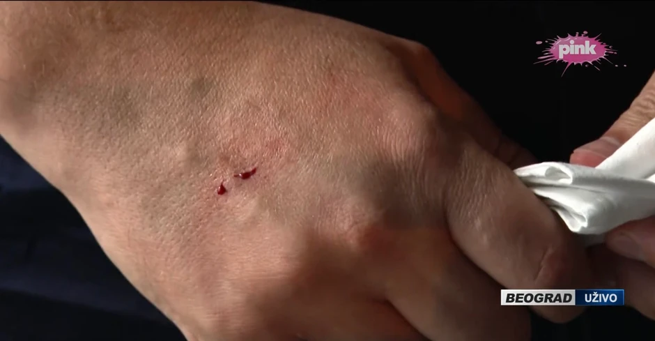 Vučić se posekao na staklo