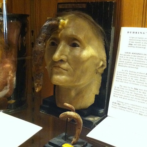 Madame Dimanche wyhodowała sobie na czole 30  róg.