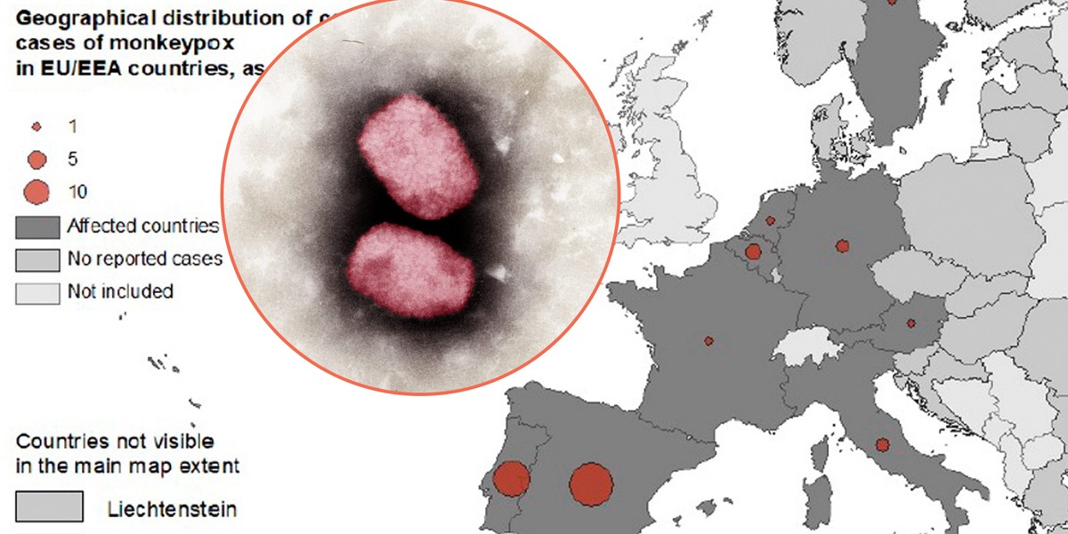 Epidemia małpiej ospy w kilku krajach – ECDC ocenia ryzyko. 