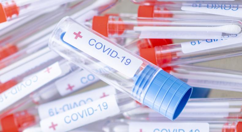 14 almajiri kids from Kano test positive for coronavirus in Kaduna. (Healthline)