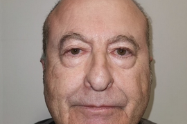 U Turskoj su mu plastičnom hirurgijom PROMENILI LIČNI OPIS! Kad vidite kako izgleda sad, nećete verovati da je TO ISTA OSOBA: Mlađi je BAR 30 GODINA