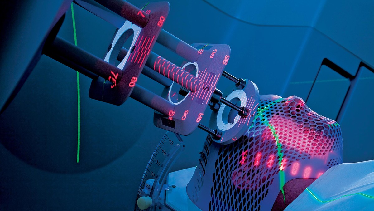 Man Receiving Radiotherapy for Cancer Treatment