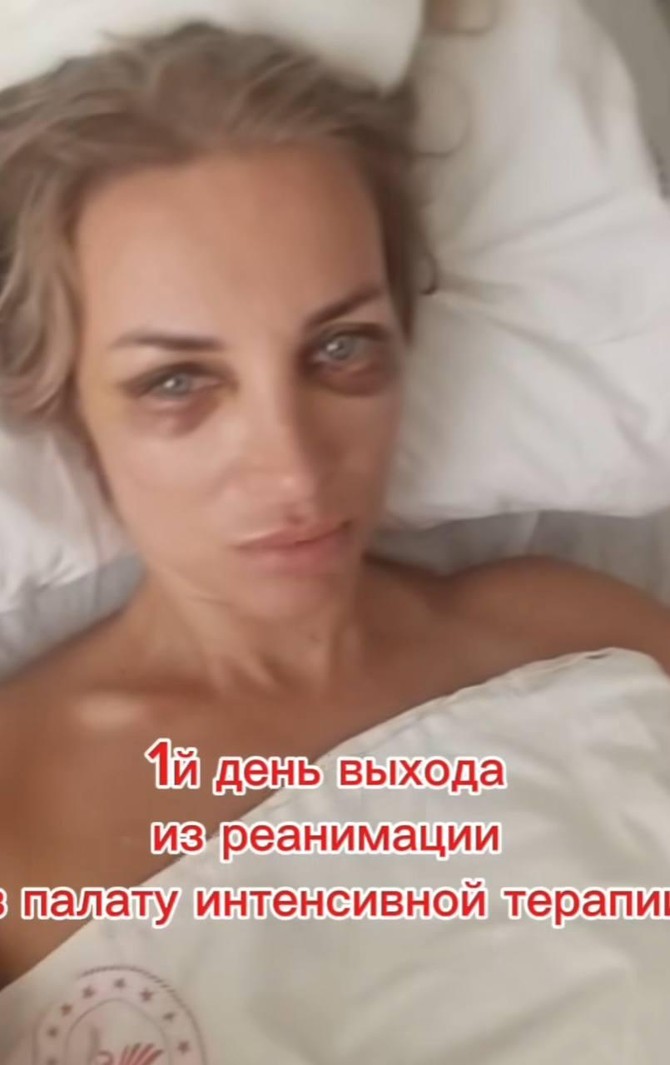 Olgina slika iz bolnice dok se oporavlja
