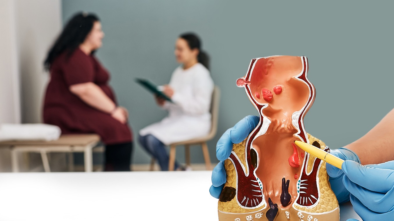 Rakovina konečníka - príznaky, liečba