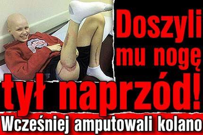 Doszyli mu nogę tył naprzód! Wcześniej amputowali kolano