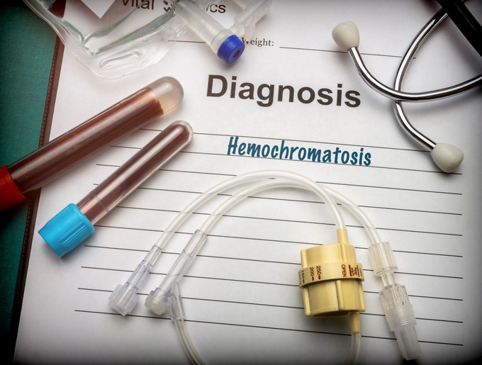 Hemokromatózis (Bronzdiabétesz): tünetei, vizsgálata és kezelési lehetőségei