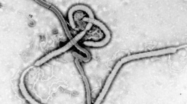 Ebola-gyanús beteget találtak Koszovóban