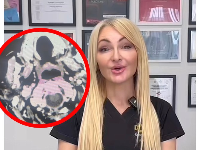 Slučaj koji je dr Davidović objavila mnoge je zabrinuo i uplašio