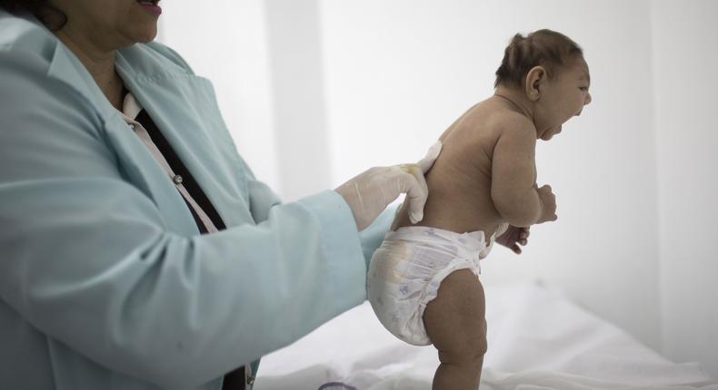 Brazil reports increase in microcephaly cases linked to Zika