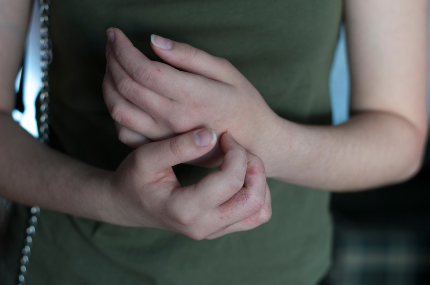 Van tela osobe uzročnik ugine za 5-7 dana, a na temperaturi od 50 stepeni Celzijusa za desetak minuta