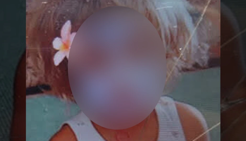 Nastradala devojčica na Karaburmi I.H. (3)