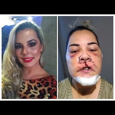 Krásna Mariana ostala so znetvorenou tvárou.