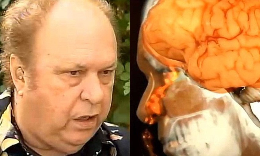 Džo Nađ je bio šokiran kada je saznao da mu iz nosa curi moždana tečnost