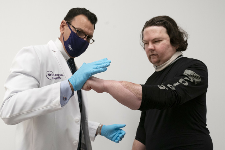 Dr Eduardo Rodriguez i Joe DiMeo - pacjent demonstruje elastyczność i siłę swoich dłoni
