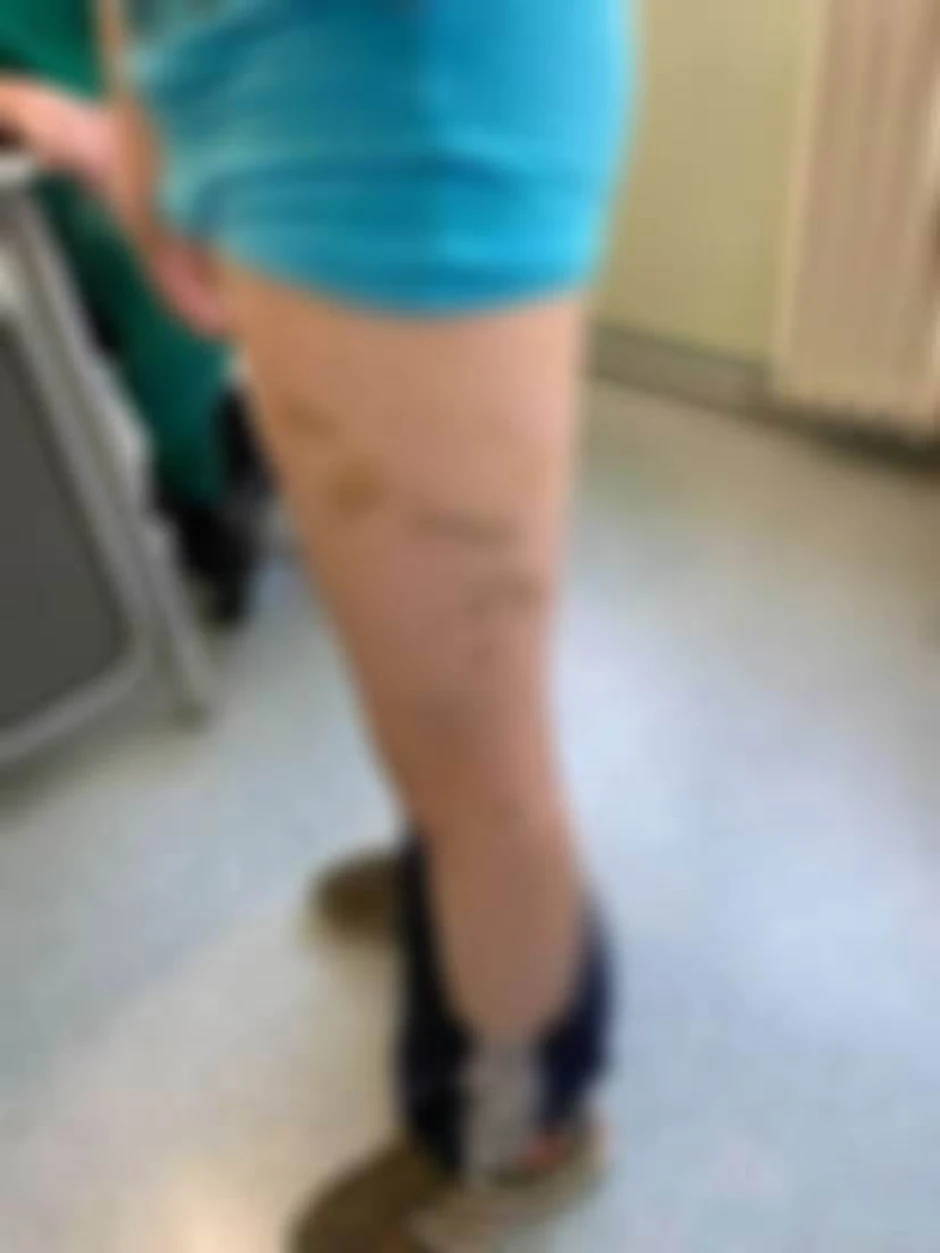 Vršnjačko nasilje na ekskurziji