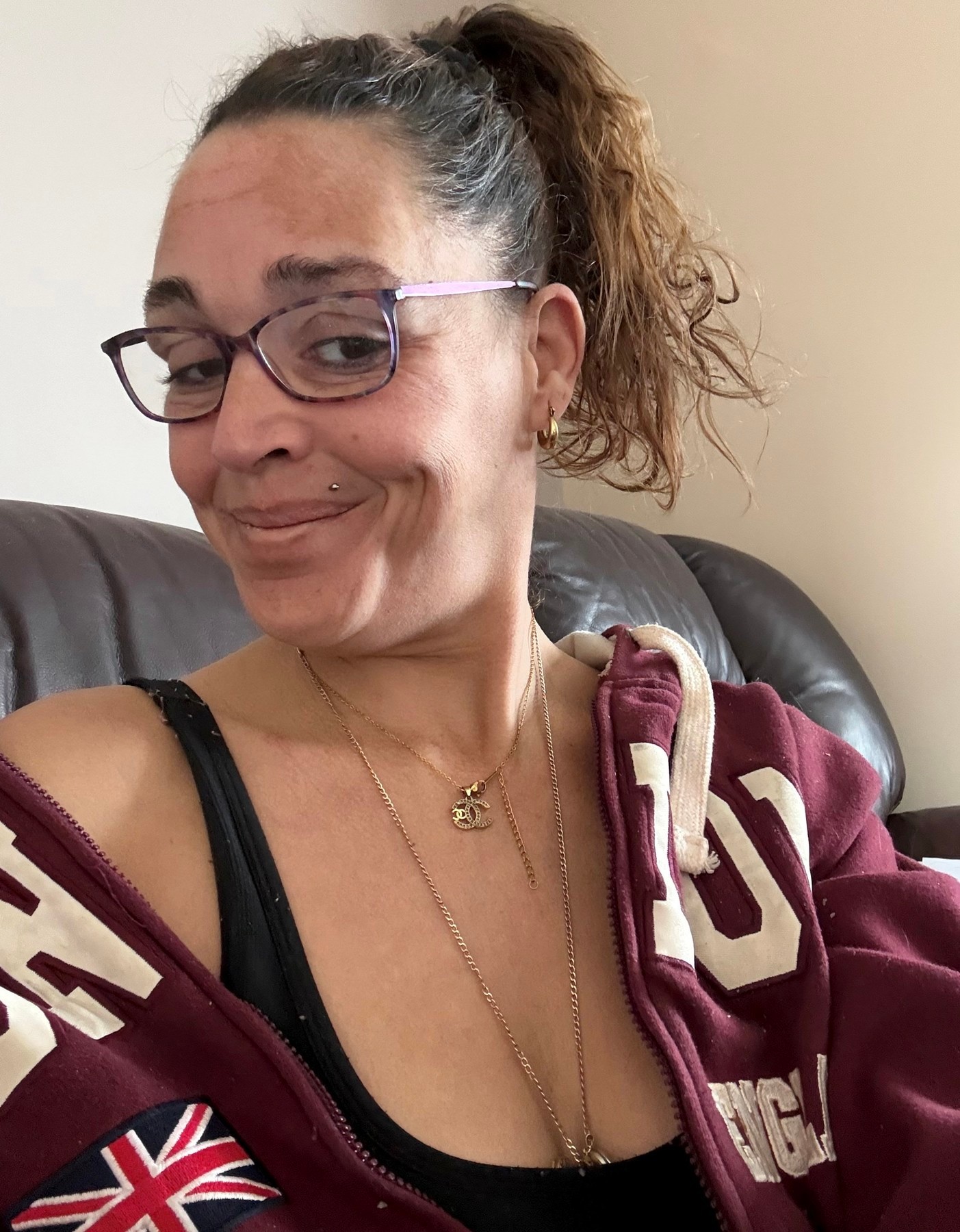 Rutinný zákrok sa pre Kelly skončil sepsou a doživotným utrpením.