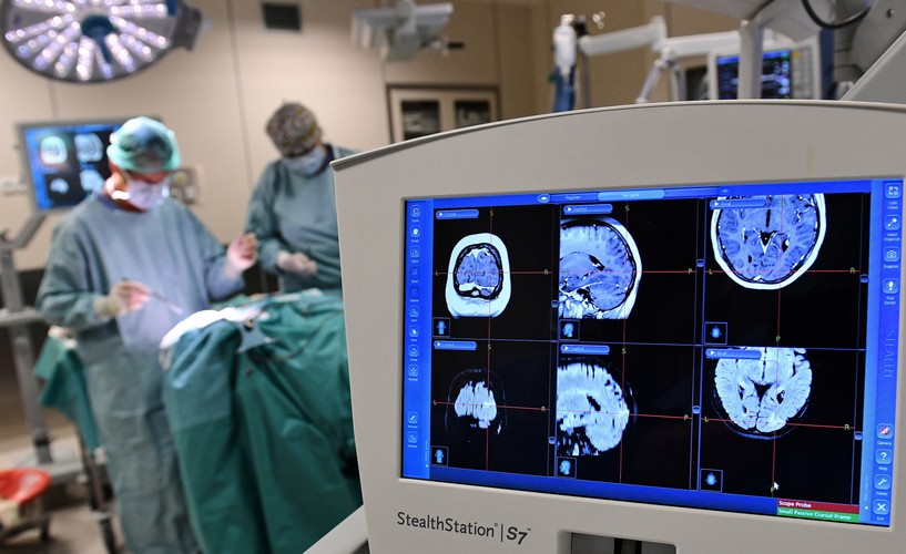 OPERACJA NA MÓZGU. TAK LECZY SIĘ PADACZKĘ LEKOOPORNĄ W SZCZECINIE