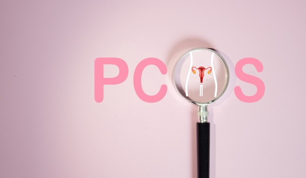 Sindrom policističnih jajnika (PSCO)  je sada poliendokrini metabolički sindrom jajnika (PMOS)
