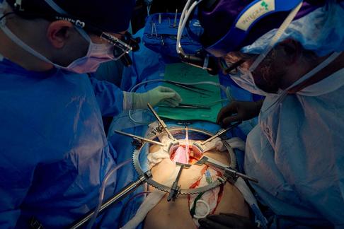 Chirurdzy z Massachusetts General Hospital w Bostonie przygotowują nerkę świni do przeszczepienia człowiekowi, 21 marca 2024 r