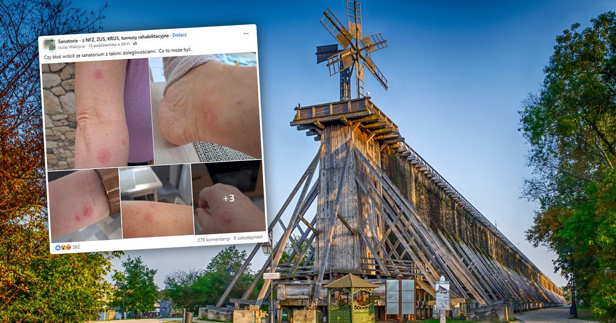 Kuracjuszka nabawiła się tego w sanatorium. Pokazała zdjęcia i rozpętała burzę w sieci