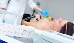 Ekg 