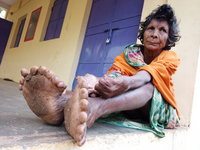 31 ujjal született egy indiai nő, akit emiatt most boszorkánynak hisznek a helyiek