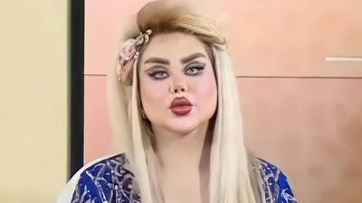 Dalia Naeem underwent 43 surgeries to look like Barbie [Instagram]