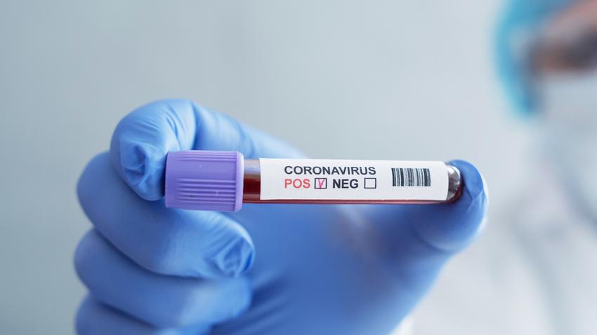 GettyImages-covid 19 teszt, koronavírus teszt