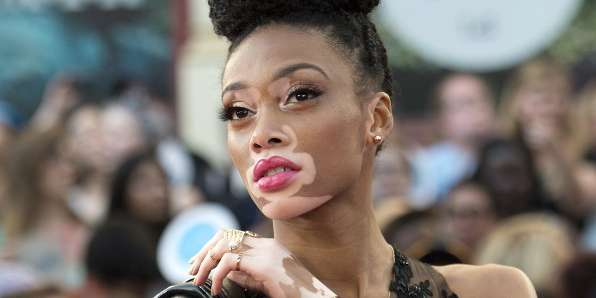 Winnie Harlow