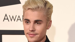 Justin Bieber fél arca lebénult: szakértő szólalt meg a nem mindennapi betegségről